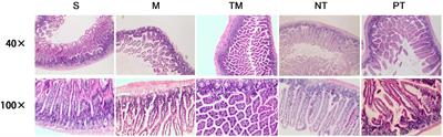 Physical Exercise Repairs Obstructive Jaundice-Induced Damage to Intestinal Mucosal Barrier Function via H2S-Mediated Regulation of the HMGB1/Toll Like Receptors 4/Nuclear Factor Kappa B Pathway